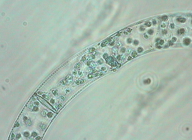 Dictyocha speculum